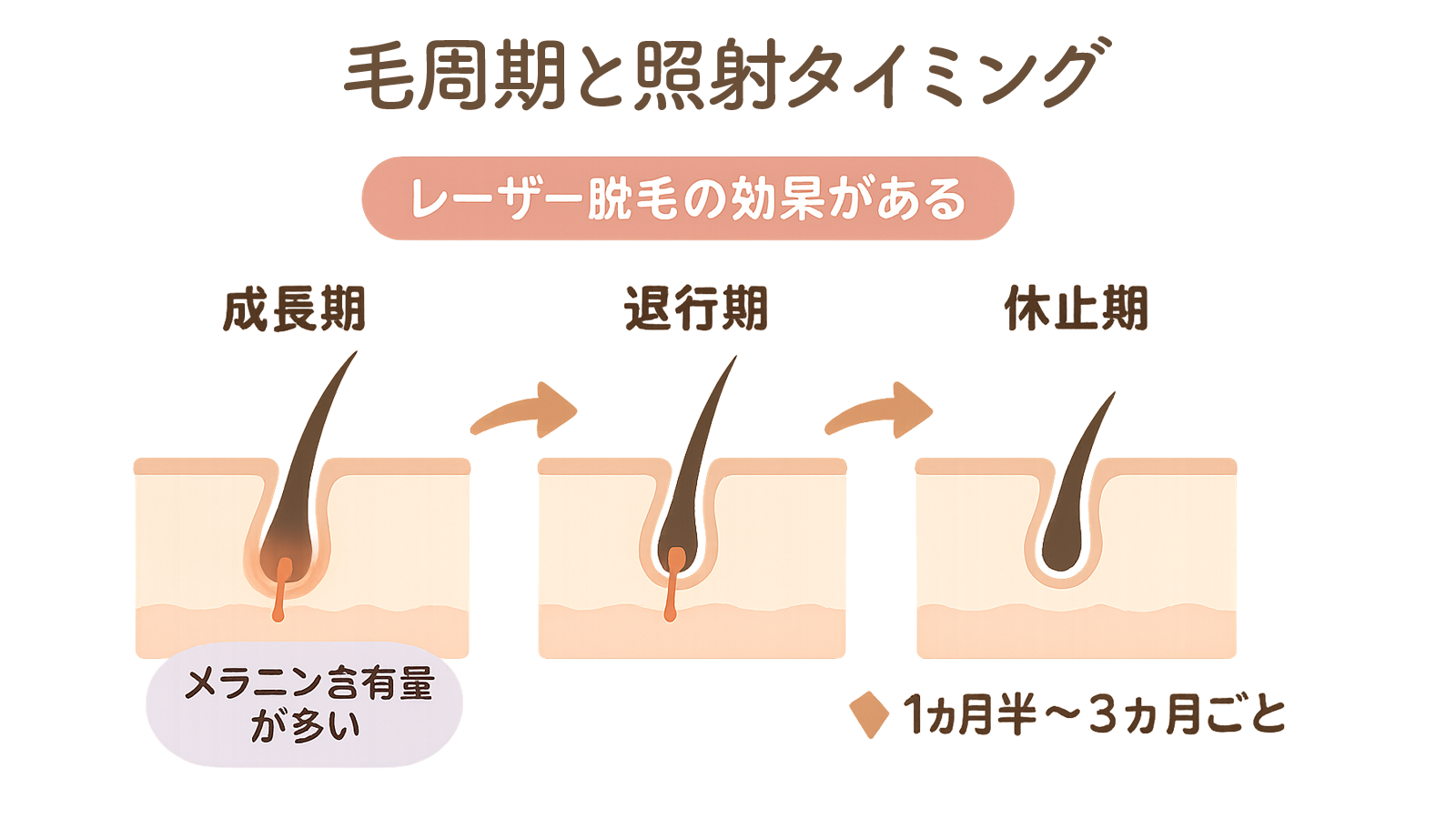毛は成長期・退行期・休止期のサイクル（毛周期）を繰り返しており、レーザー脱毛では特にメラニン含有量が多い成長期の毛に効果があります。