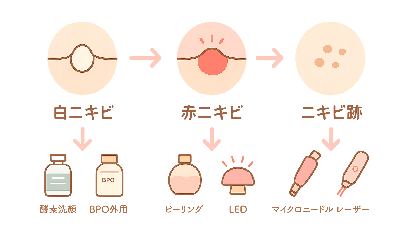 ニキビの症状別治療法